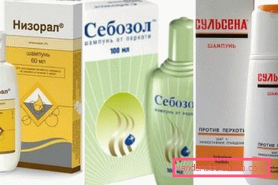 nizoral, sebozol e sulsen nizoral, sebozol e sulsen