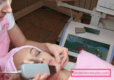 Depilazione ultrasonica sul viso Depilazione ultrasonica sul viso
