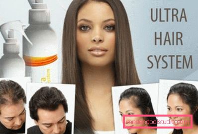 trattamento di alopecia trattamento di alopecia