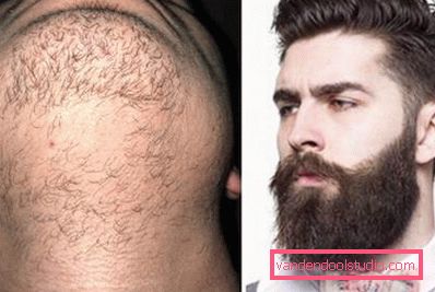 barba barba