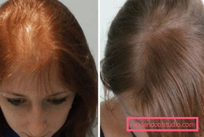 acconciatura femminile acconciatura femminile