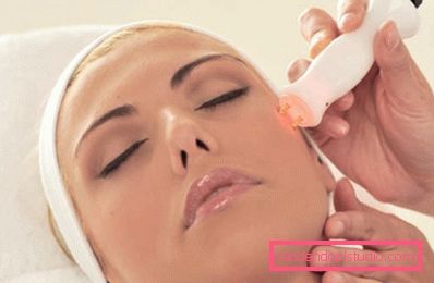 procedura di thermage procedura di thermage