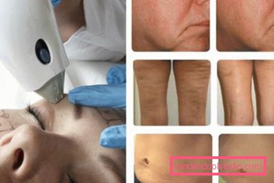 effetto dalla cosmetologia hardware effetto dalla cosmetologia hardware