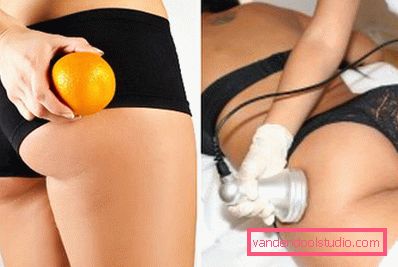 la lotta contro la cellulite la lotta contro la cellulite