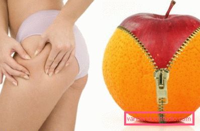 cellulite alle gambe cellulite alle gambe