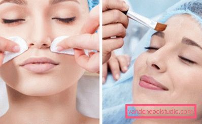 Peeling retinoico