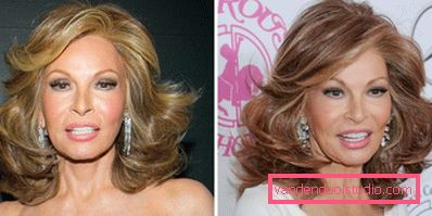 Acconciature per capelli medi per le donne dopo 60 anni di foto Acconciature femminili per capelli medi - foto di stile bello e leggero per donne di diverse età